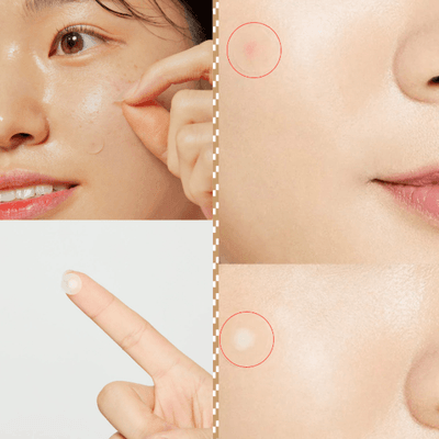 COSRX Acne Pimple Master Patch_img_6